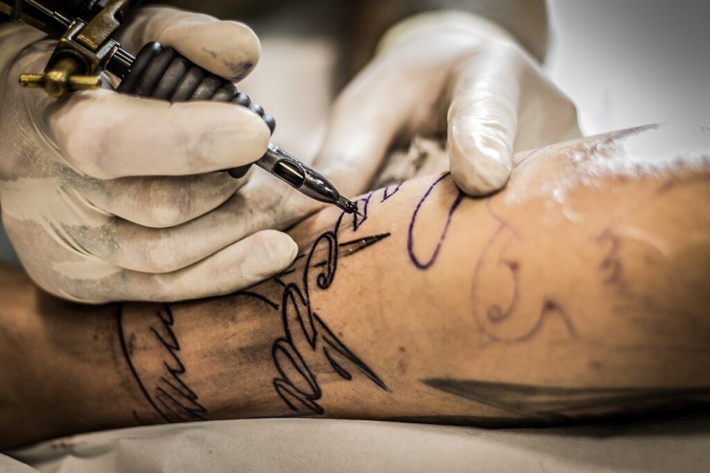 Tätowierung Tattoo Tattooentfernung Was gibt es zu beachten